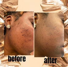 Load image into Gallery viewer, Natural Soap Kit