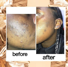 Load image into Gallery viewer, Natural Soap Kit